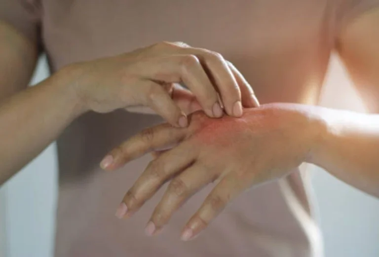 How Long Hands Foot and Mouth Contagious