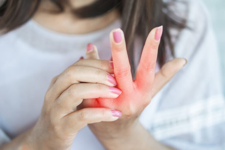 Broken Blood Vessel on Finger: Risk Factors and Care Tips Broken blood vessel on finger causing purple discoloration and mild swelling